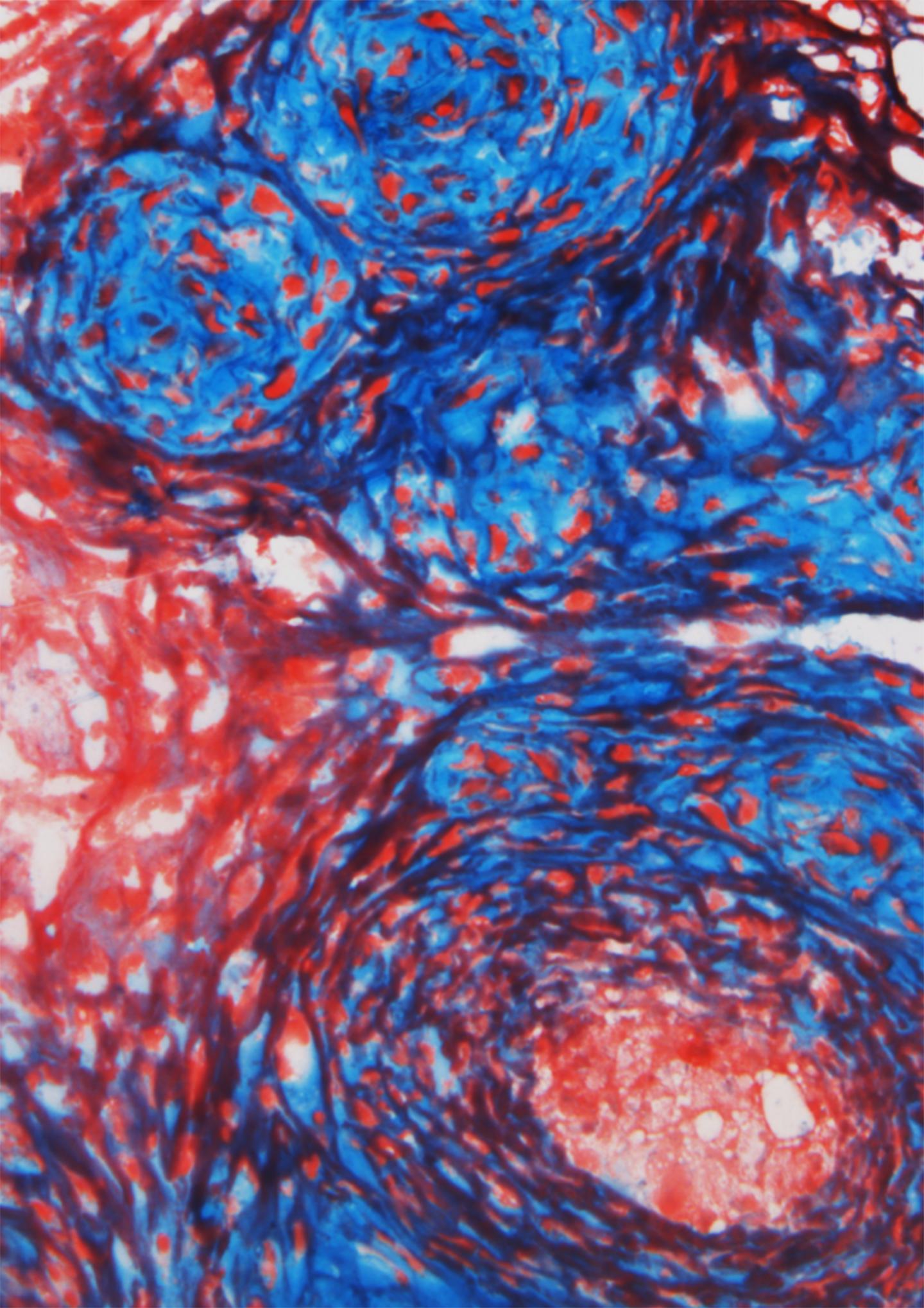 Inside the Knee