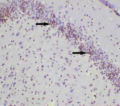 The Effect of <i>Scutellaria baicalensis</i>