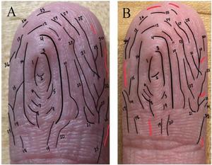 Establishing wrinkle pairs