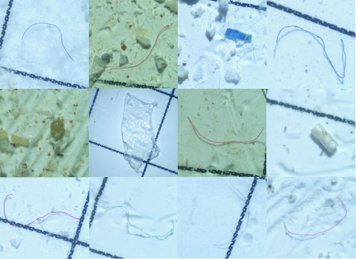 First characterization and risk assessment of microplastics in the endangered Indus River dolphin (Platanista minor): Implications for conservation strategies