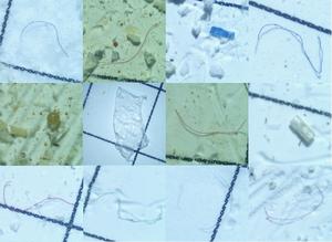 First characterization and risk assessment of microplastics in the endangered Indus River dolphin (Platanista minor): Implications for conservation strategies
