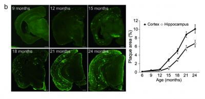 Abeta Pathology in First Model (APPNL-F/NL-F) Brains
