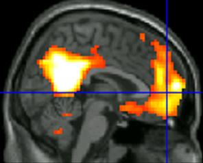 Effects of Mindfulness in PTSD