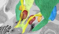 Deep Brain Stimulation