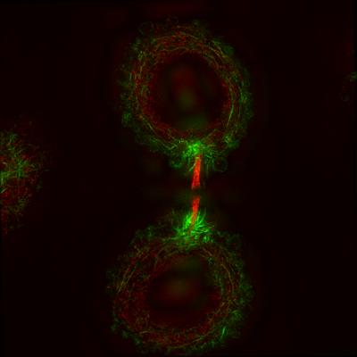 Twist on Last Step of Cell Division (8 of 9)
