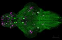 Zebrafish Brain in Response to Nmu Overexpression
