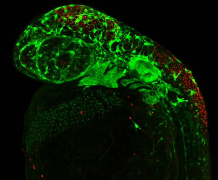 Cell Death