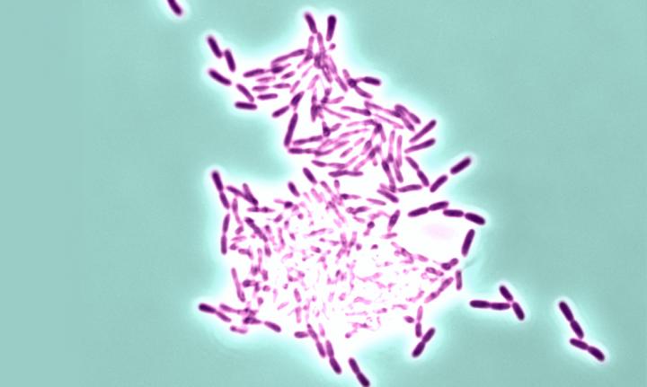 <i>Pseudomonas</i> Biofilm