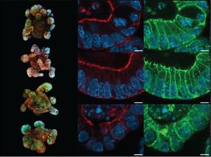 Mapping key proteins on gut organoids