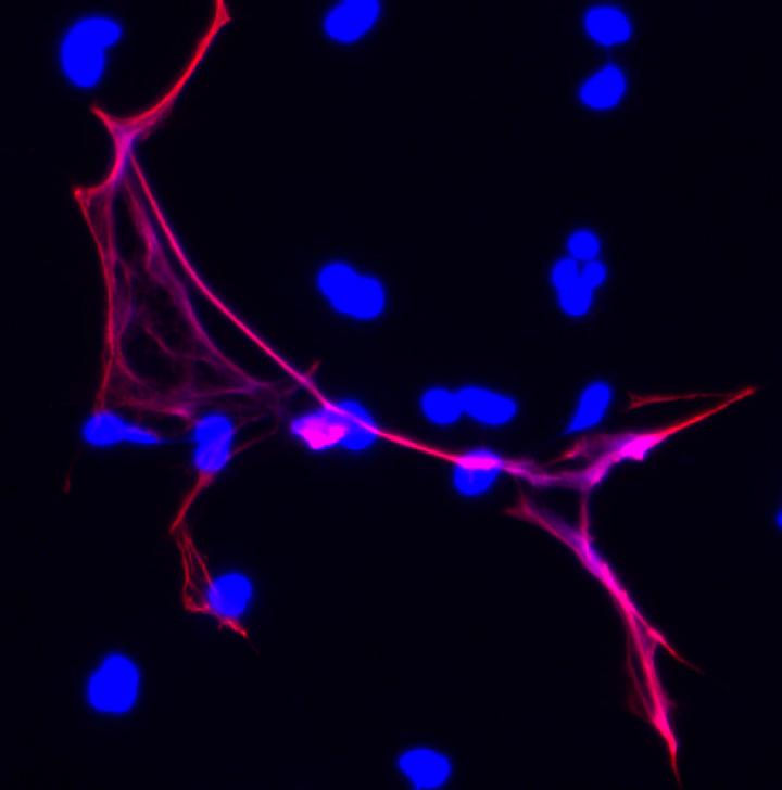 Disabling Infection-Fighting Immune Response Speeds up Wound Healing in Diabetes