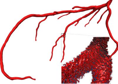 3-D Model of Artery