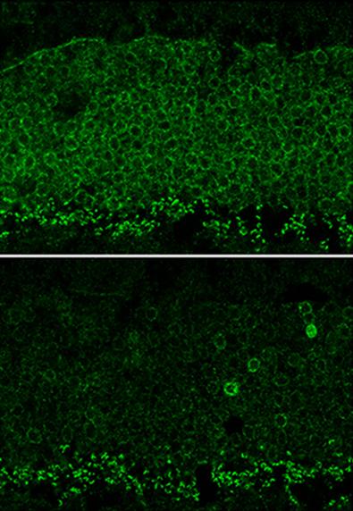 Nrl Gene Expression in Mouse Retina