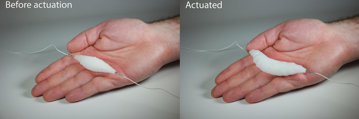 Muscle at Rest and Expanded on Hand