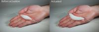 Muscle at Rest and Expanded on Hand