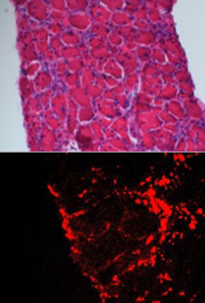Diaphragm Muscle of a Mouse