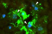 Tumor-Derived Exosomes