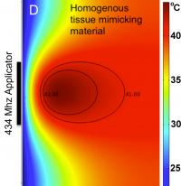 Temperature Profile