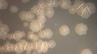Bacteria