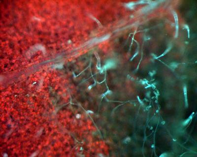 <I>Phytopthora infestans</I> Invading Potato Leaf