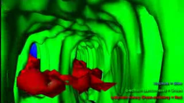 Direct Reprogramming of a Heart Muscle Cell