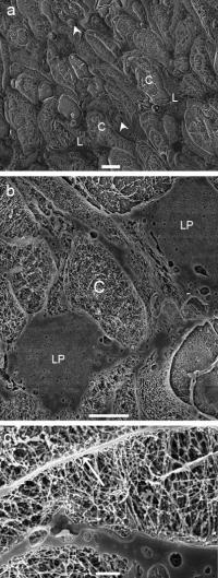 Cryo-Scanning Electron Microscopy Pictures of Vernix Caseosa