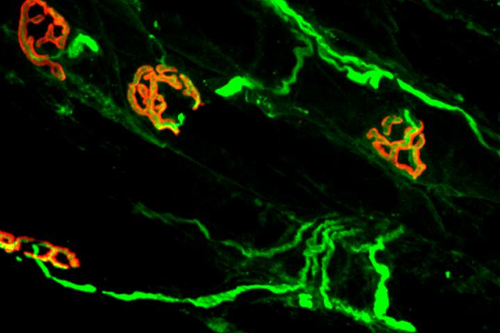 NIH funding bolsters rare diseases research collaborations