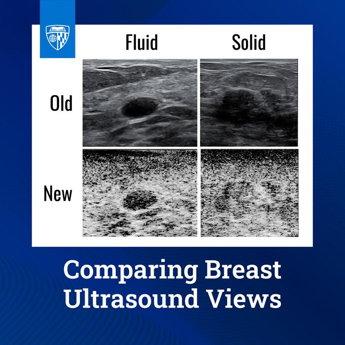 Comparing Breast Ultrasound Views
