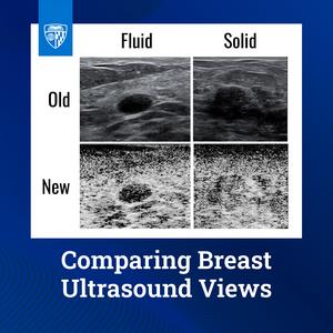 Comparing Breast Ultrasound Views