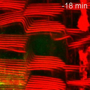Video of Cell Wall Assembly