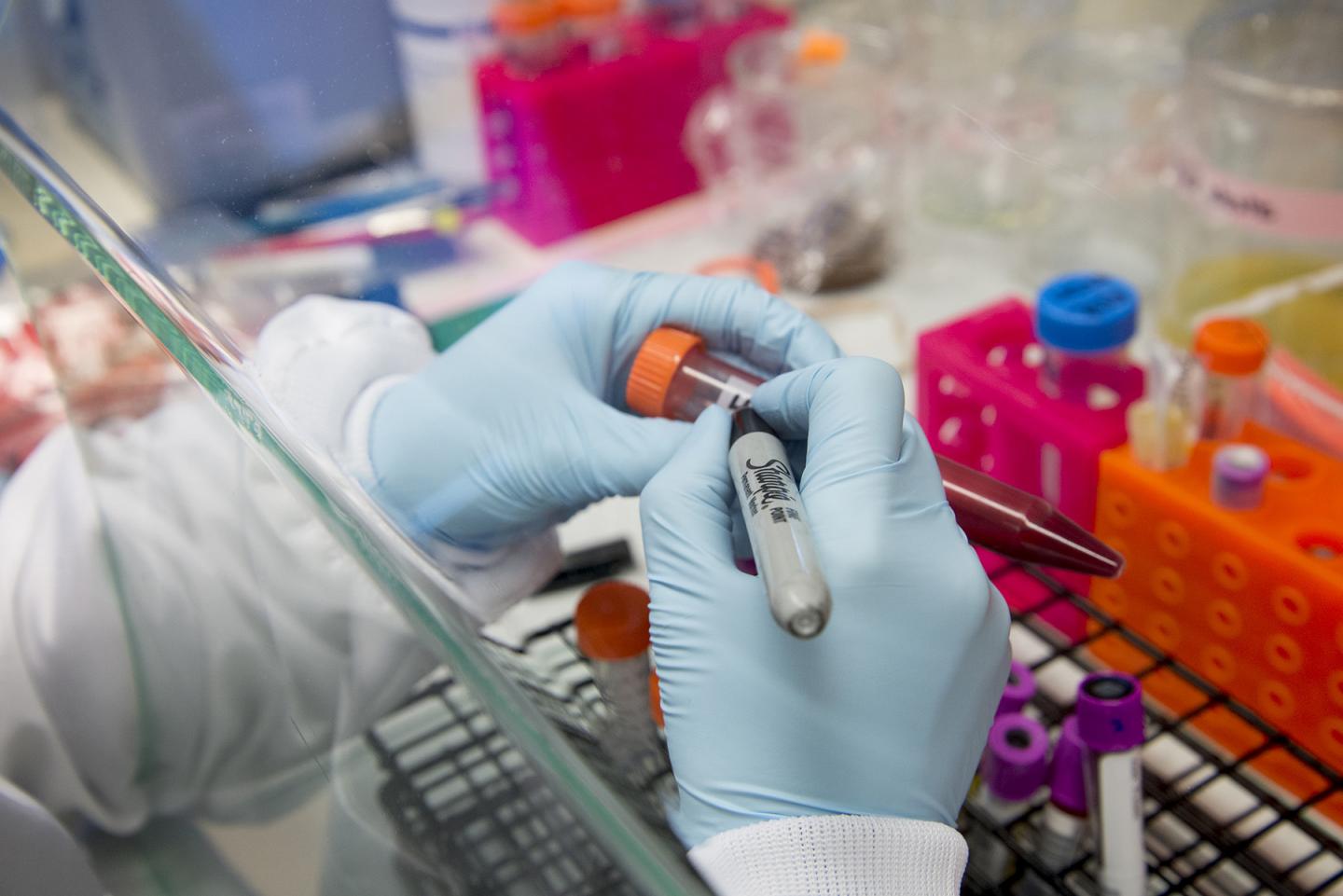 Precision Diagnostics Research