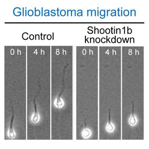 Shootin1b is a potential target for the inhibition of glioblastoma motility