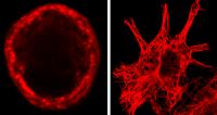 Acetylated Tubulin in a Single Sensory Neuron Soma vs. in a Non-Neuronal Cell