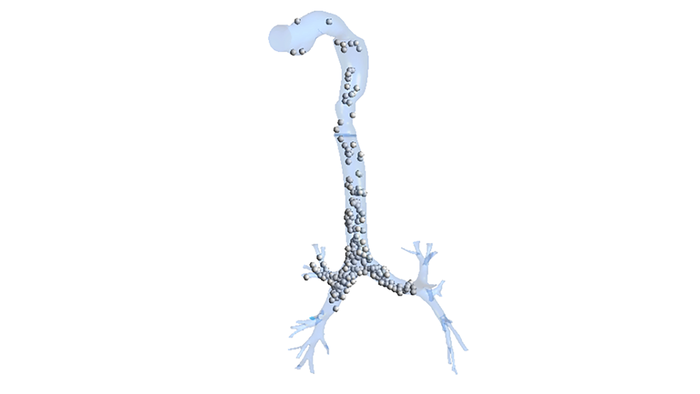 Spatial distribution of single micron-sized drug particles in human respiratory tract