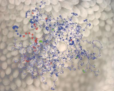 Gut Bacteria Aid Cancer Therapies (4 of 4)