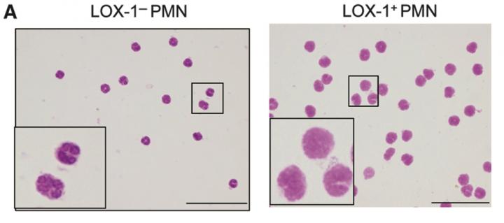 Good Cell, Bad Cell: What Makes Them Different? (2 of 2)