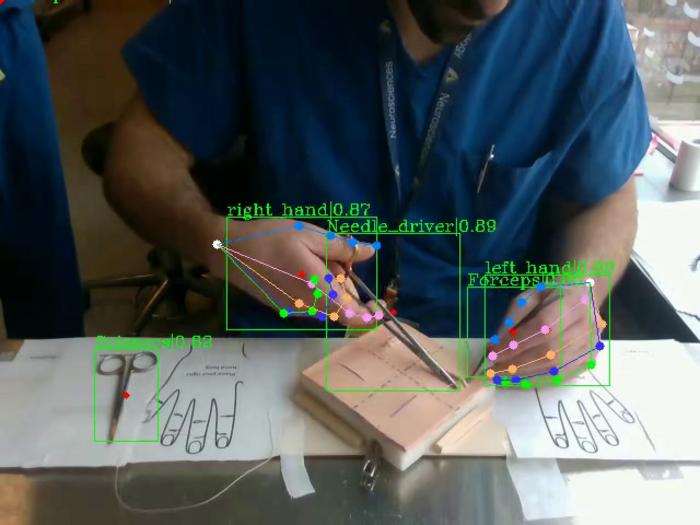 Photo 1: New AI Could Teach the Next Generation of Surgeons