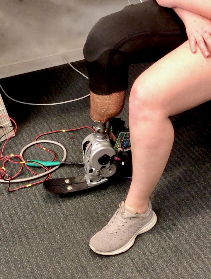 Prosthetic