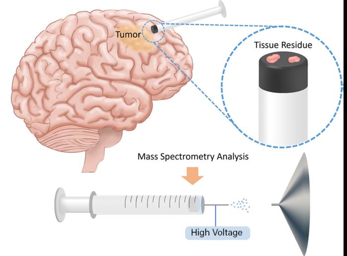 Mass spectrometry offers faster look at the edges of brain tumors