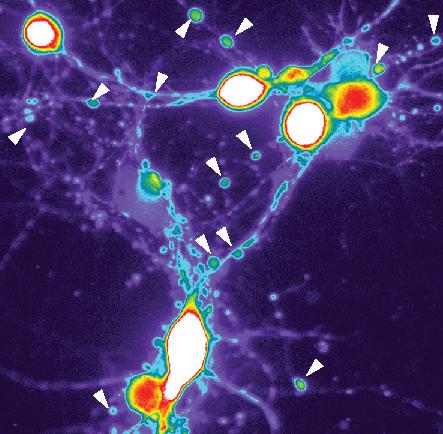 Cohen Neuron Alzheimers