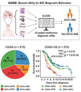 GUIDE: An AI-powered tool for glioma diagnosis.