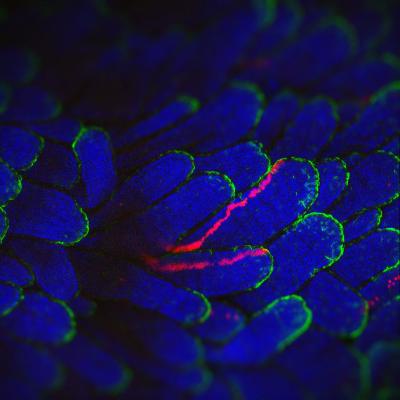 Cells with Mutations Don't Always Win (1 of 4)