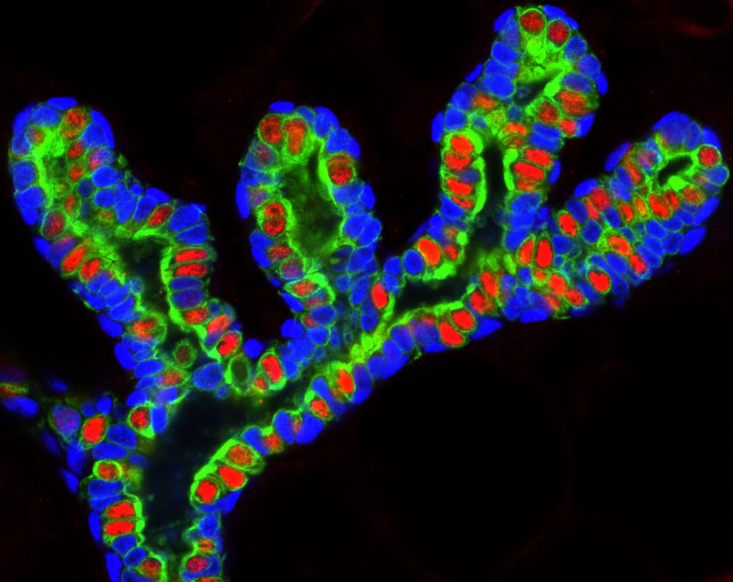 Salk Scientists Find Molecular Mechanism that Underlies Metastatic Breast Cancer