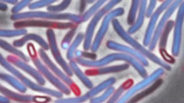 1 Researcher's Quest to Prevent Hospital-Associated Infections