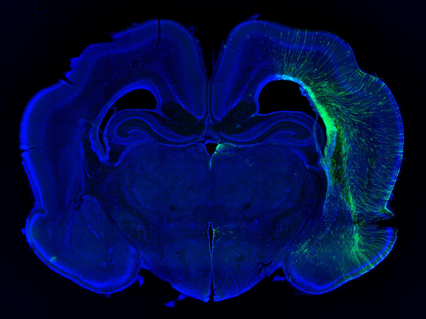 Developing Brain