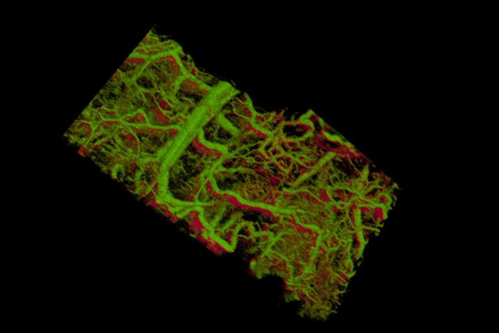 Blood Vessels in the Ear of a Mouse
