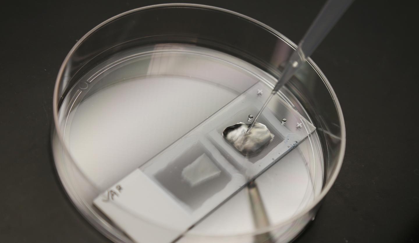 Expansion Microscopy