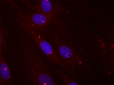 Toxic RNA
