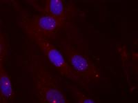 Toxic RNA