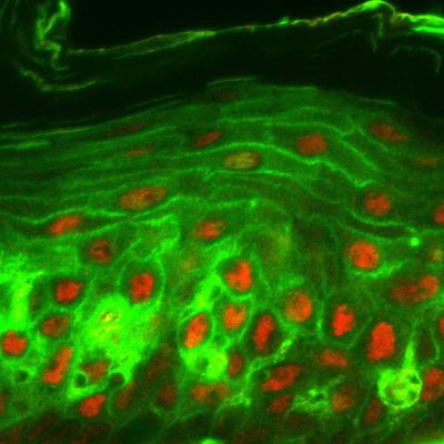 Cell Damage Caused By Brushing May Help Keep Gums Healthy (1 of 2)