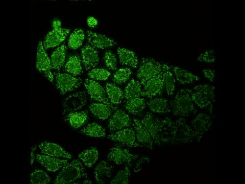 Scientists Trigger Self-Destruct Switch in Lung Cancer Cells